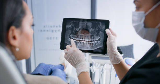 Licensed Tooth Extraction service in Port Chester, NY - Smile Center Dentistry